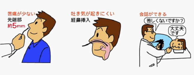 nasal_endoscope_photo1